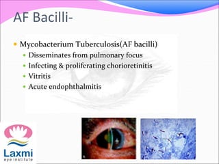 AF Bacilli-
 Mycobacterium Tuberculosis(AF bacilli)
 Disseminates from pulmonary focus
 Infecting & proliferating chorioretinitis
 Vitritis
 Acute endophthalmitis
 