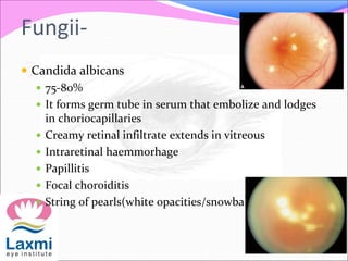 Fungii-
 Candida albicans
 75-80%
 It forms germ tube in serum that embolize and lodges
in choriocapillaries
 Creamy retinal infiltrate extends in vitreous
 Intraretinal haemmorhage
 Papillitis
 Focal choroiditis
 String of pearls(white opacities/snowball)
 
