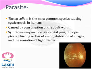 Parasite-
 Taenia solium is the most common species causing
cysticercosis in humans
 Caused by consumption of the adult worm
 Symptoms may include periorbital pain, diplopia,
ptosis, blurring or loss of vision, distortion of images,
and the sensation of light flashes
 