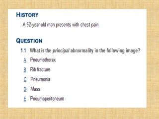 Metástases pulmonares final