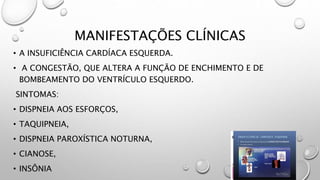 MANIFESTAÇÕES CLÍNICAS
• A INSUFICIÊNCIA CARDÍACA ESQUERDA.
• A CONGESTÃO, QUE ALTERA A FUNÇÃO DE ENCHIMENTO E DE
BOMBEAMENTO DO VENTRÍCULO ESQUERDO.
SINTOMAS:
• DISPNEIA AOS ESFORÇOS,
• TAQUIPNEIA,
• DISPNEIA PAROXÍSTICA NOTURNA,
• CIANOSE,
• INSÔNIA
 