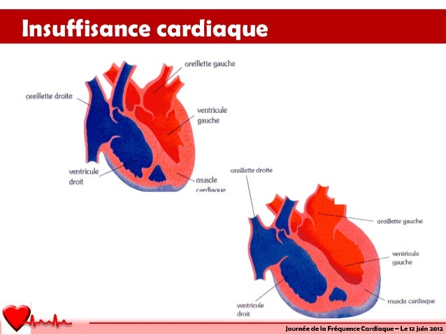 Meurin c'est quoi la fréquence cardiaque