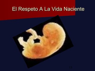 13
El Respeto A La Vida NacienteEl Respeto A La Vida Naciente
 