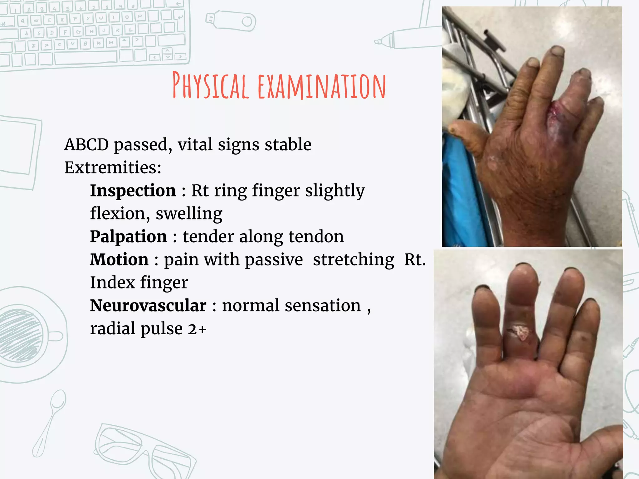 Physical examination
ABCD passed, vital signs stable
Extremities:
Inspection : Rt ring finger slightly
flexion, swelling
Palpation : tender along tendon
Motion : pain with passive stretching Rt.
Index finger
Neurovascular : normal sensation ,
radial pulse 2+
 