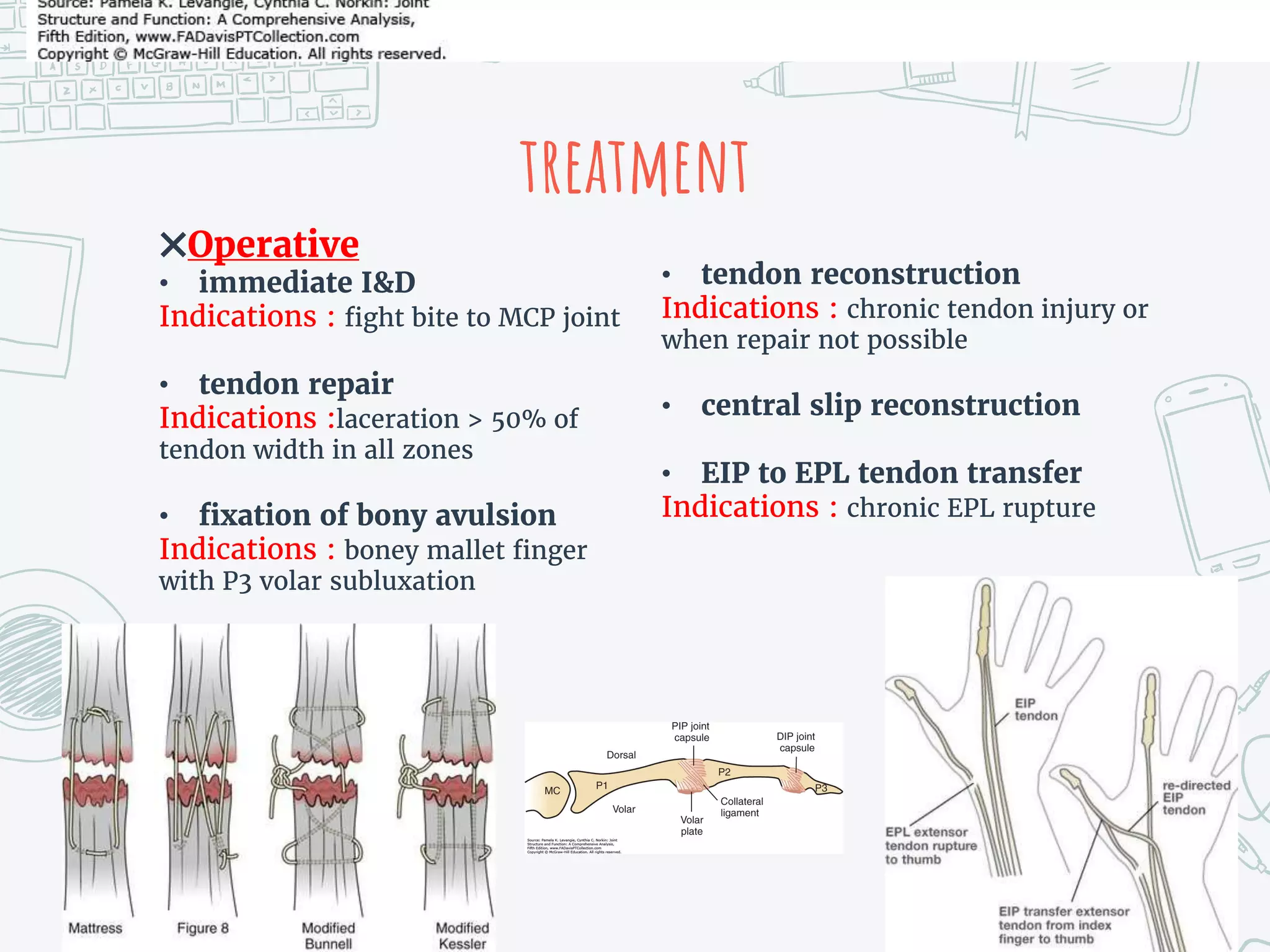 treatment
✖Operative
• immediate I&D
Indications : fight bite to MCP joint
• tendon repair
Indications :laceration > 50% of
tendon width in all zones
• fixation of bony avulsion
Indications : boney mallet finger
with P3 volar subluxation
• tendon reconstruction
Indications : chronic tendon injury or
when repair not possible
• central slip reconstruction
• EIP to EPL tendon transfer
Indications : chronic EPL rupture
 