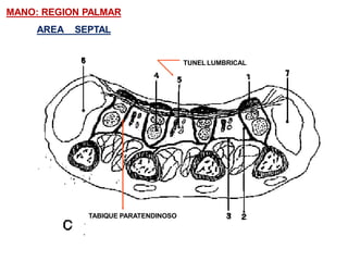 MANO: REGION PALMAR
AREA SEPTAL
TABIQUE PARATENDINOSO
TUNEL LUMBRICAL
 