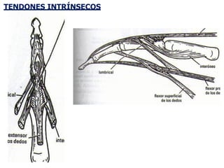 TENDONES INTRÍNSECOS
 