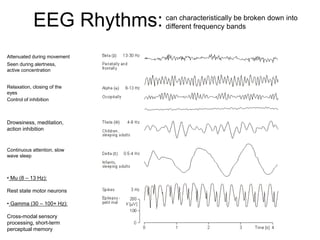 EEG Rhythms:
Attenuated during movement
Seen during alertness,
active concentration
Relaxation, closing of the
eyes
Control of inhibition
Drowsiness, meditation,
action inhibition
Continuous attention, slow
wave sleep
• Mu (8 – 13 Hz):
Rest state motor neurons
• Gamma (30 – 100+ Hz):
Cross-modal sensory
processing, short-term
perceptual memory
can characteristically be broken down into
different frequency bands
 