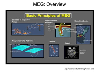MEG: Overview
http://web.mit.edu/kitmitmeg/whatis.html
 