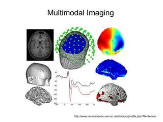Multimodal Imaging
http://www.neuroscience.cam.ac.uk/directory/profile.php?RikHenson
 