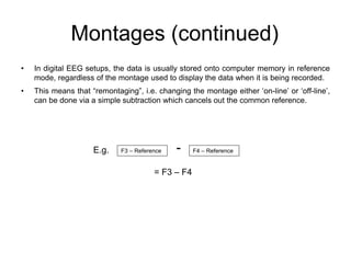 Montages (continued)
• In digital EEG setups, the data is usually stored onto computer memory in reference
mode, regardless of the montage used to display the data when it is being recorded.
• This means that “remontaging”, i.e. changing the montage either ‘on-line’ or ‘off-line’,
can be done via a simple subtraction which cancels out the common reference.
F3 – Reference F4 – Reference
-
= F3 – F4
E.g.
 