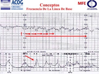 Conceptos
Frecuencia De La Línea De Base
 