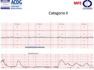 Variabilidad mínima
Categoría II
 