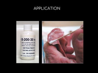 Mfp Toothpaste MAXILLOFACIAL PROSTHETIC MATERIALS (MFP MATERIALS) | PPTX
