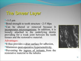 Smearing Adhesion Example Compositerestoration | PPT