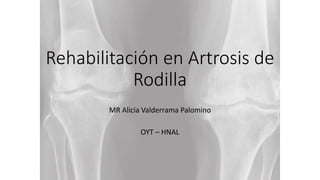 Rehabilitación en Artrosis de
Rodilla
MR Alicia Valderrama Palomino
OYT – HNAL
 