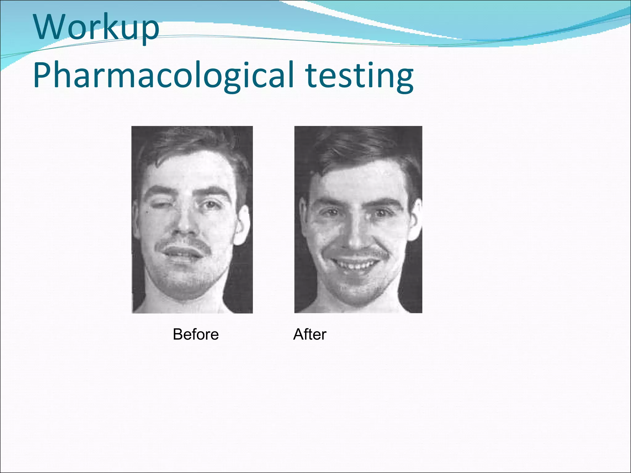 Workup Pharmacological testing Before   After 