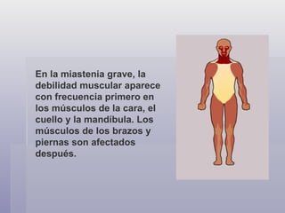En la miastenia grave, la debilidad muscular aparece con frecuencia primero en los músculos de la cara, el cuello y la mandíbula. Los músculos de los brazos y piernas son afectados después.  