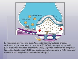 La miastenia grave ocurre cuando el sistema inmunológico produce anticuerpos que destruyen el receptor ACh (AChR), un lugar de conexión para el químico nervioso acetilcolina (ACh). Algunos tratamientos bloquean la acetilcolinesterasa (AChE), una enzima que descompone la ACh, mientras que otros son dirigidos al sistema inmunológico. 