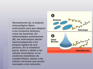 Normalmente (A), el sistema inmunológico libera anticuerpos para que ataquen a los invasores foráneos, como las bacterias. En enfermedades autoinmunes (B), los anticuerpos atacan equivocadamente a los propios tejidos de una persona. En la miastenia grave, atacan y dañan a las células musculares; en el síndrome miasténico de Lambert-Eaton, atacan a las células nerviosas que envían mensajes a los músculos. 