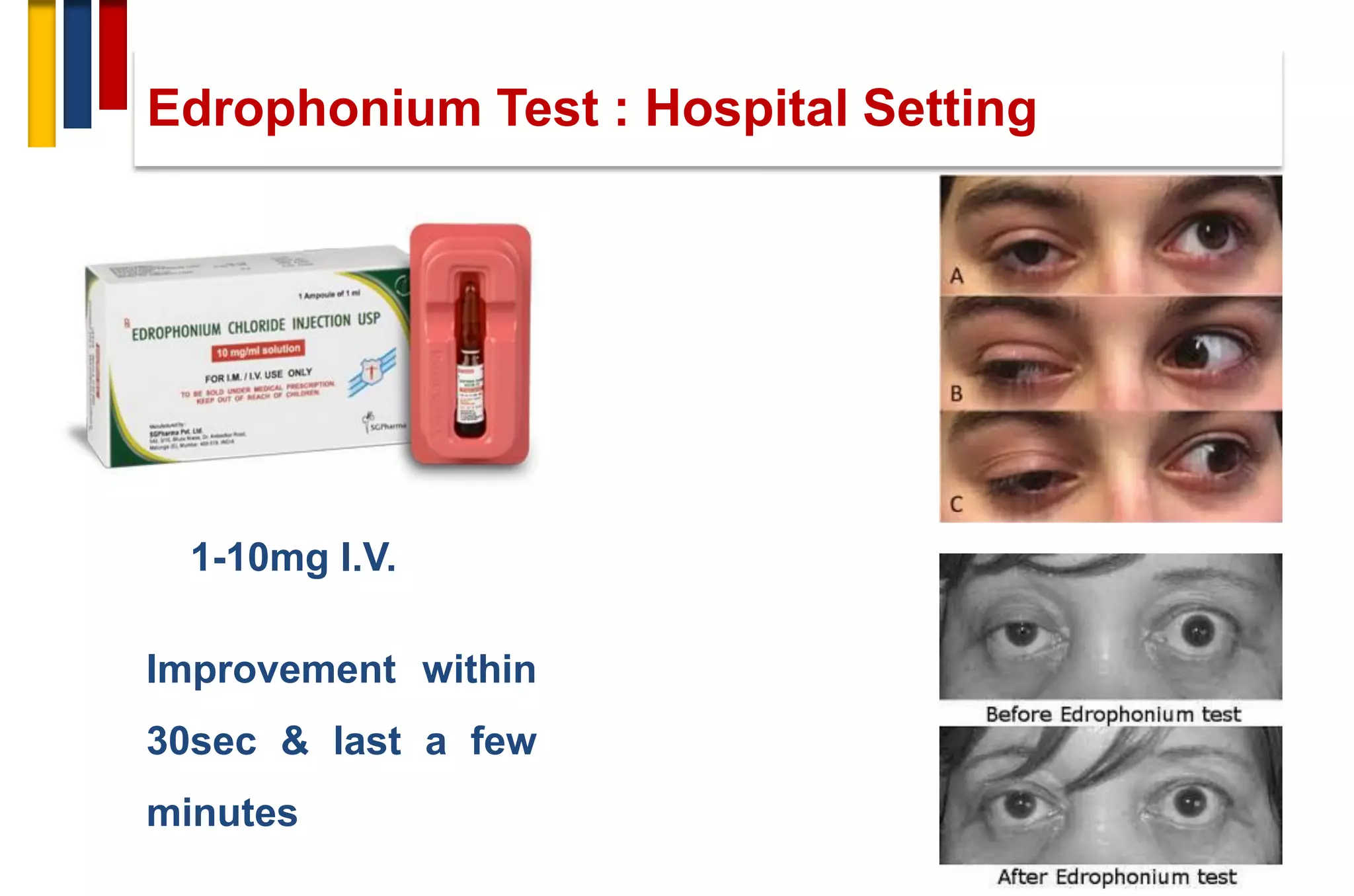 1-10mg I.V.
Improvement within
30sec & last a few
minutes
Edrophonium Test : Hospital Setting
 