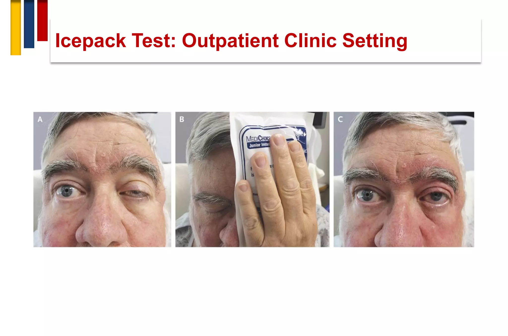 Icepack Test: Outpatient Clinic Setting
 