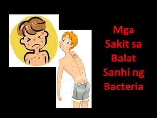 Mga
Sakit sa
Balat
Sanhi ng
Bacteria
 