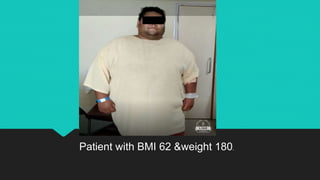 Patient with BMI 62 &weight 180.
 