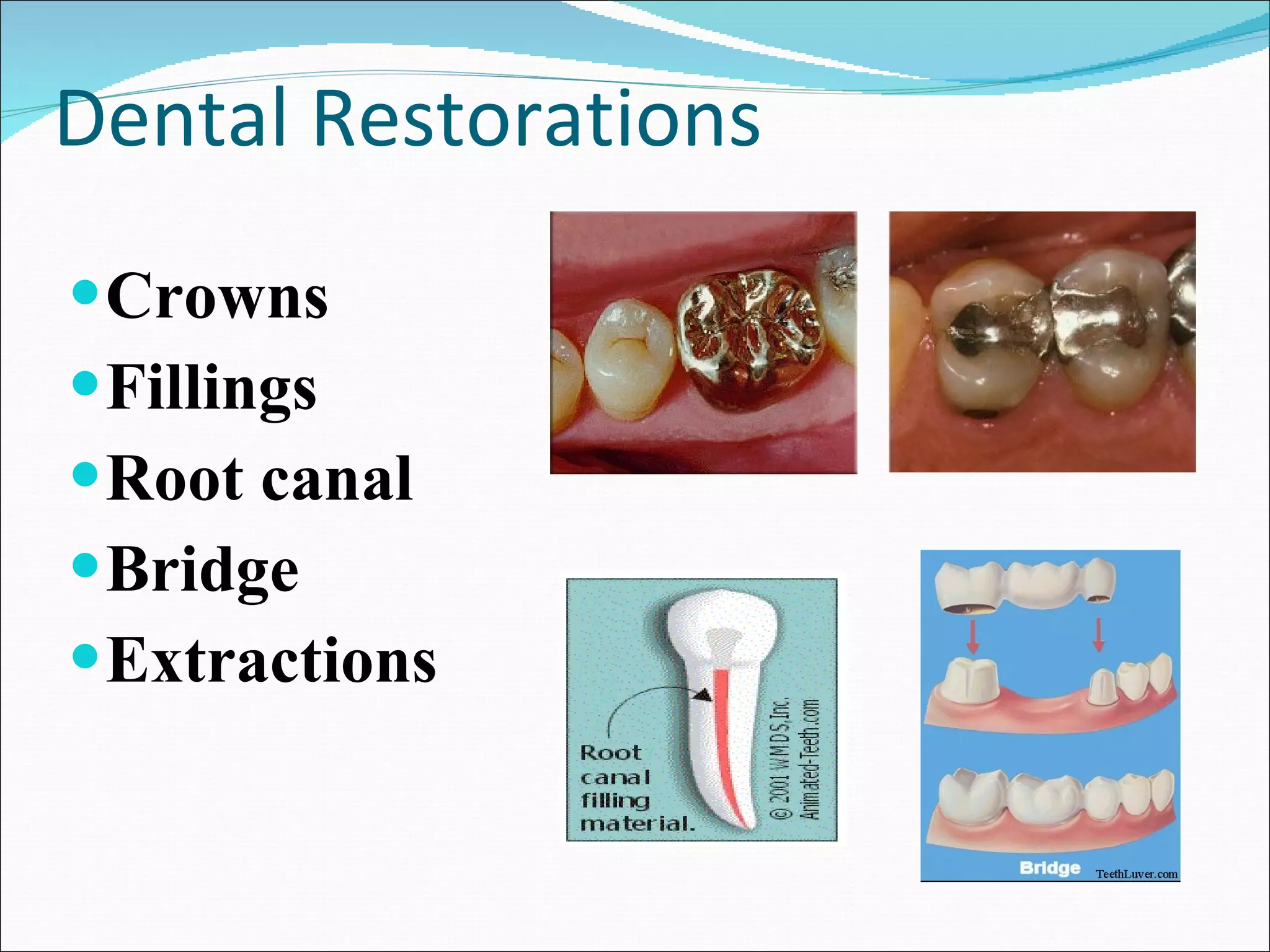 Dental Restorations Crowns Fillings Root canal Bridge Extractions 