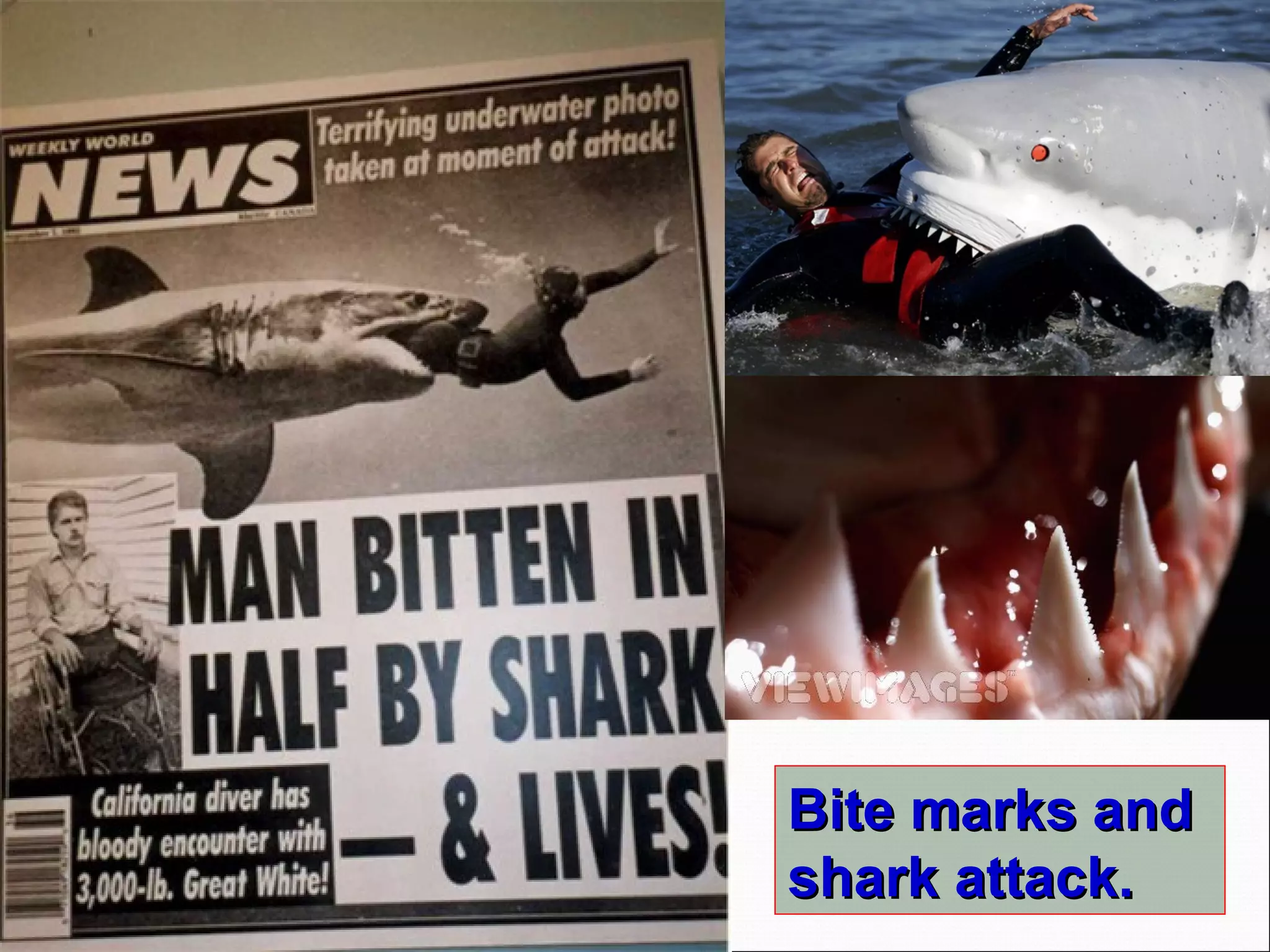 Bite marks and shark attack. 