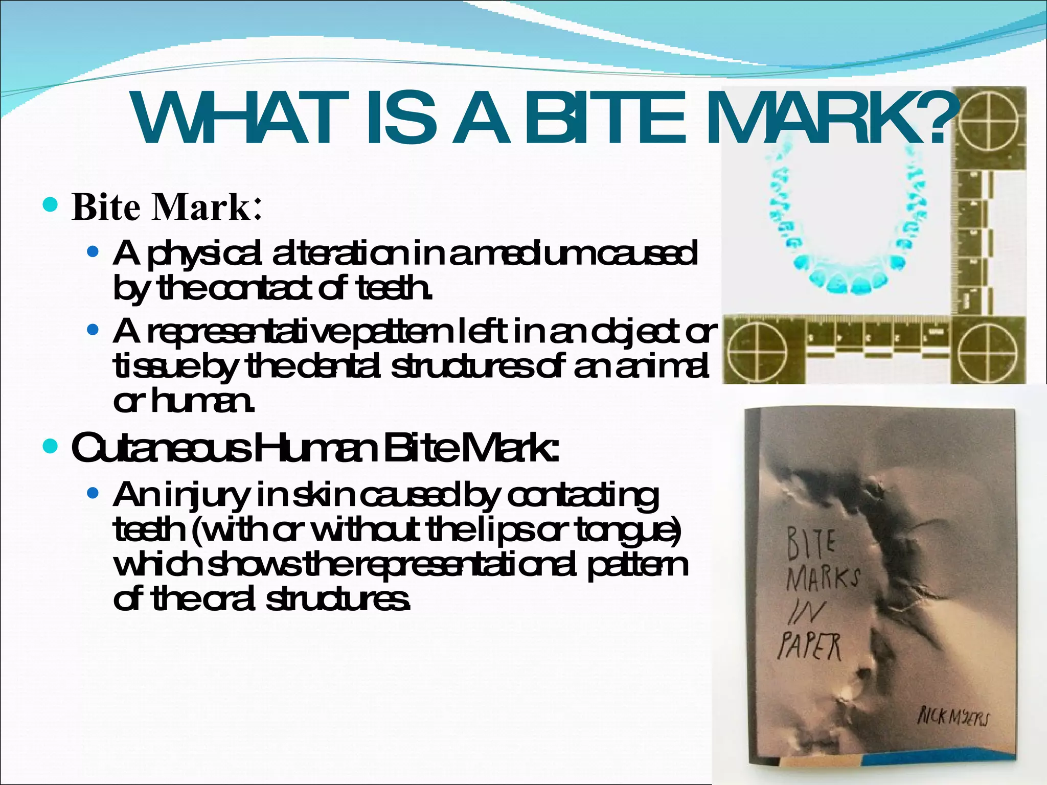 WHAT IS A BITE MARK? Bite Mark: A physical alteration in a medium caused by the contact of teeth.  A representative pattern left in an object or tissue by the dental structures of an animal or human.  Cutaneous Human Bite Mark: An injury in skin caused by contacting teeth (with or without the lips or tongue) which shows the representational pattern of the oral structures.  