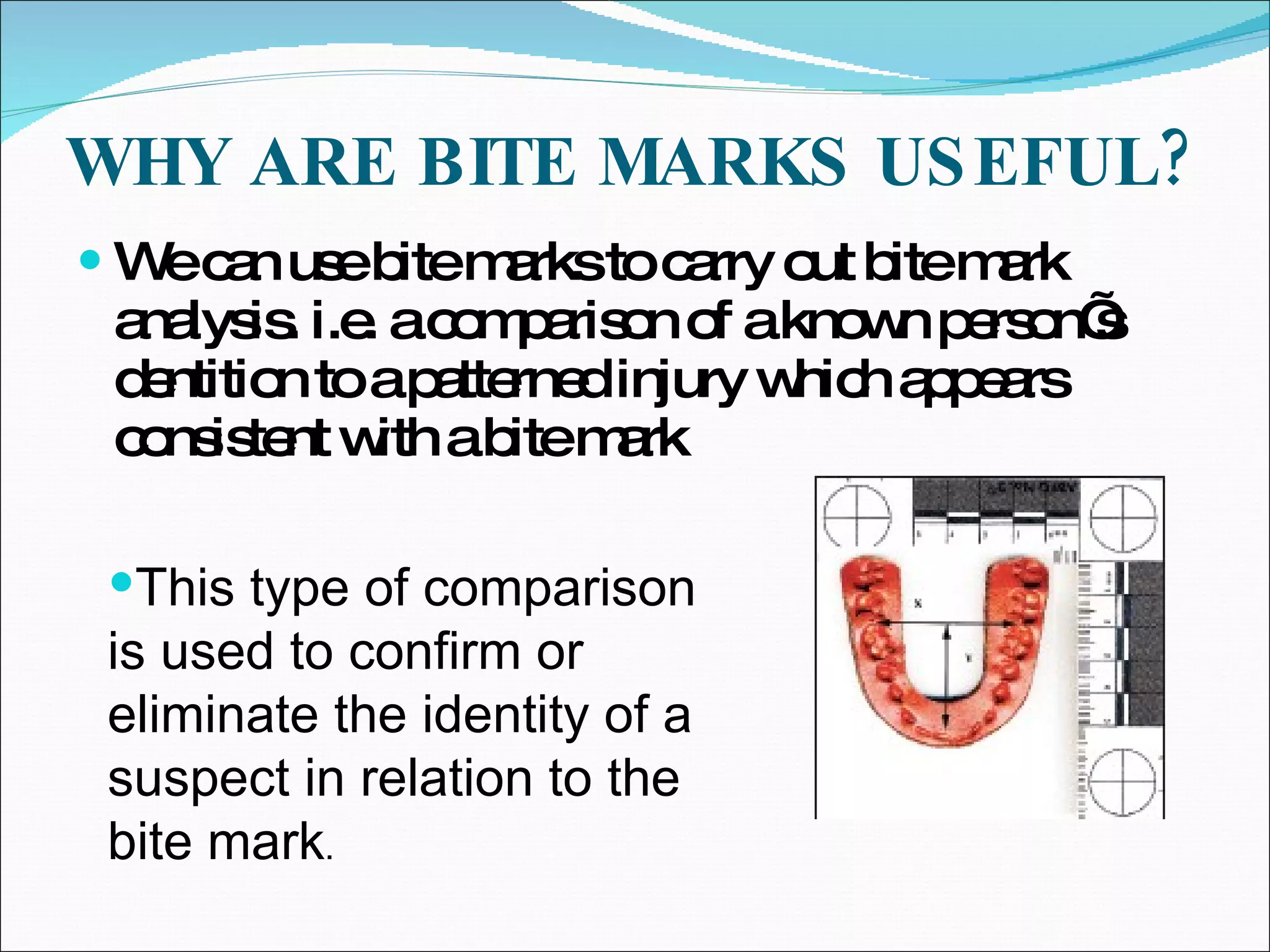 WHY ARE BITE MARKS USEFUL? We can use bite marks to carry out bite mark analysis. i.e. a comparison of a known person’s dentition to a patterned injury which appears consistent with a bite mark This type of comparison is used to confirm or eliminate the identity of a suspect in relation to the bite mark . 
