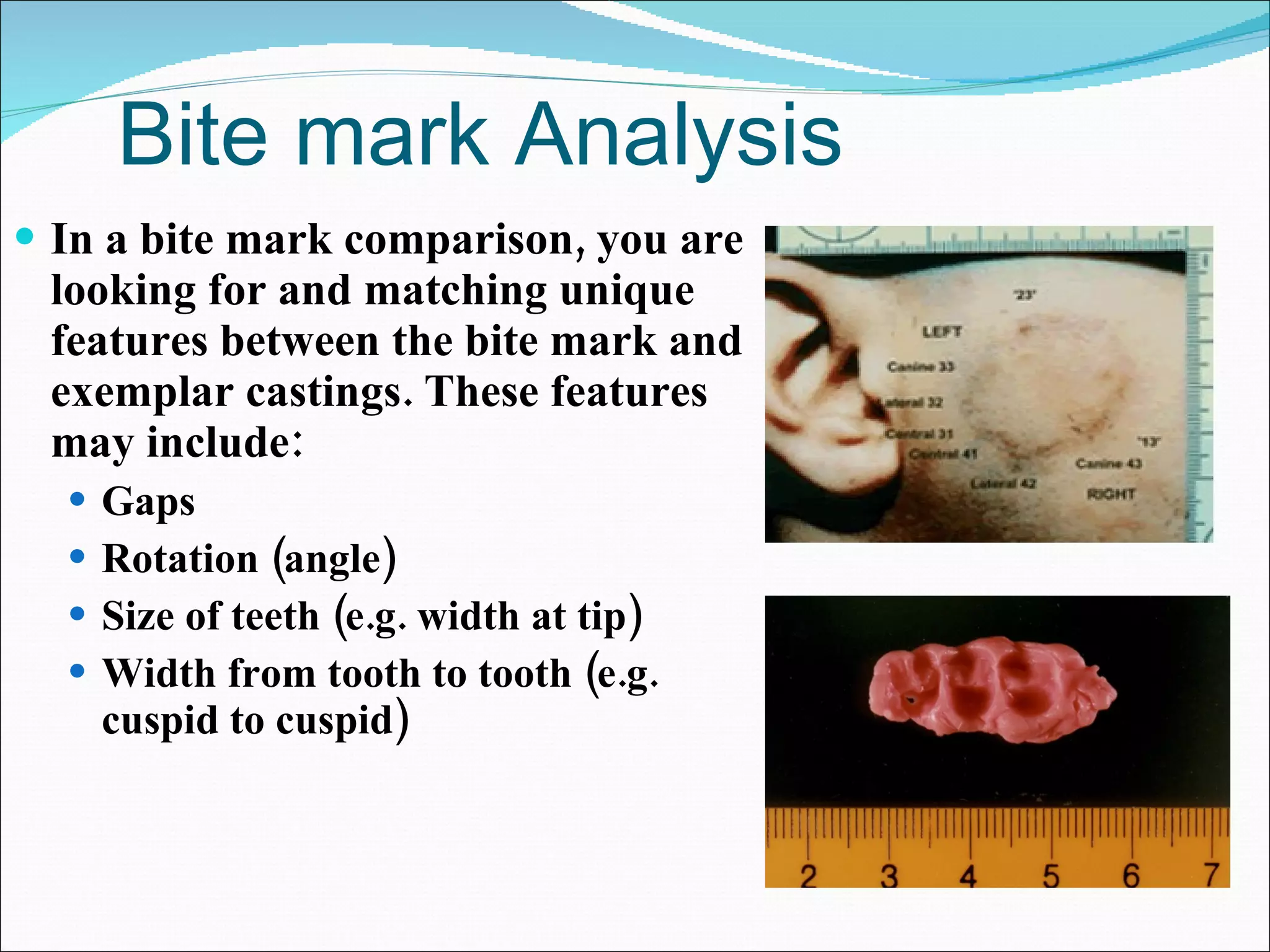 Bite mark Analysis In a bite mark comparison, you are looking for and matching unique features between the bite mark and exemplar castings. These features may include: Gaps Rotation (angle) Size of teeth (e.g. width at tip) Width from tooth to tooth (e.g. cuspid to cuspid) 