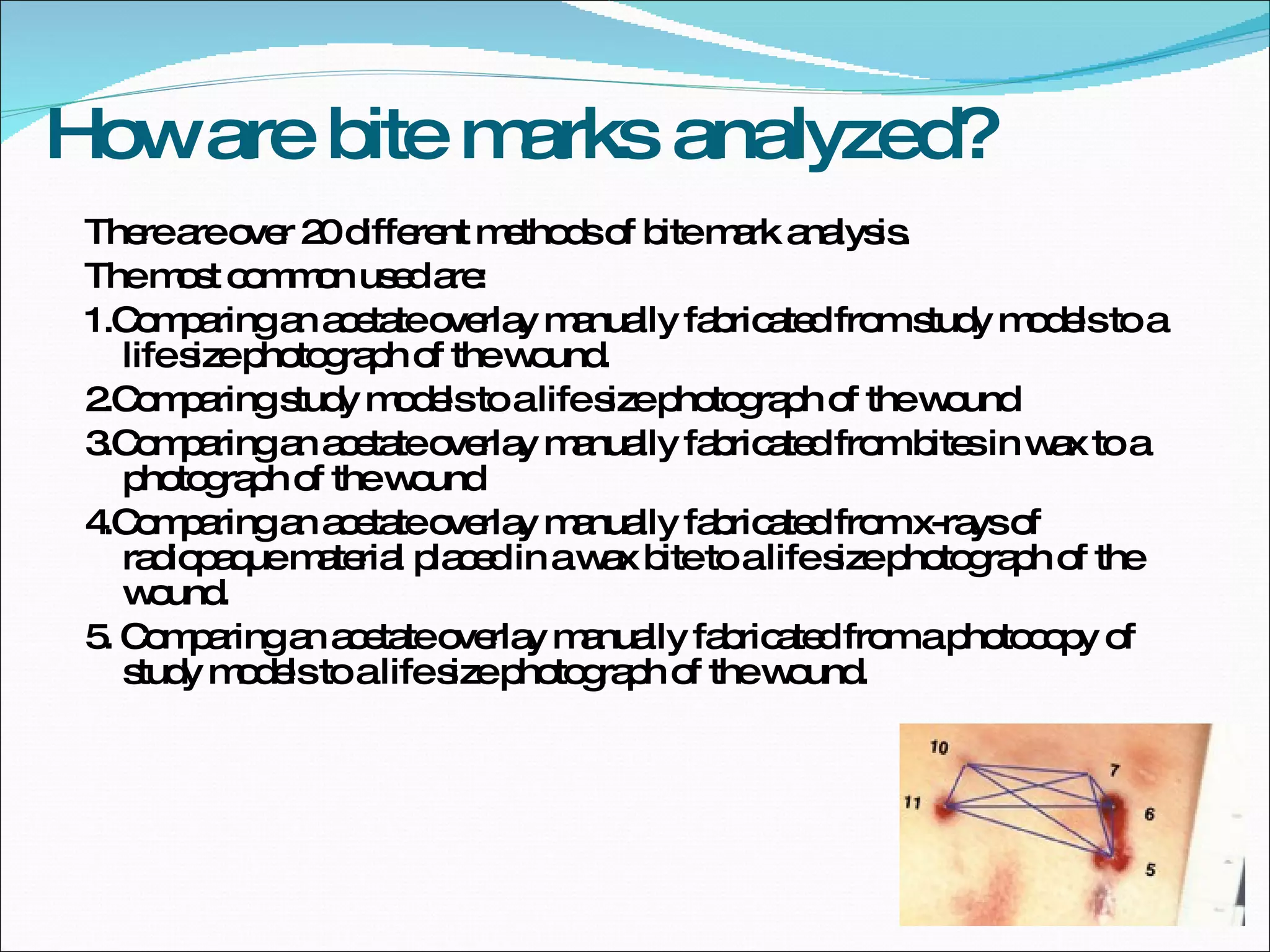 How are bite marks analyzed? There are over 20 different methods of bite mark analysis. The most common used are: 1.Comparing an acetate overlay manually fabricated from study models to a life size photograph of the wound. 2.Comparing study models to a life size photograph of the wound 3.Comparing an acetate overlay manually fabricated from bites in wax to a photograph of the wound  4.Comparing an acetate overlay manually fabricated from x-rays of radiopaque material placed in a wax bite to a life size photograph of the wound. 5. Comparing an acetate overlay manually fabricated from a photocopy of study models to a life size photograph of the wound. 