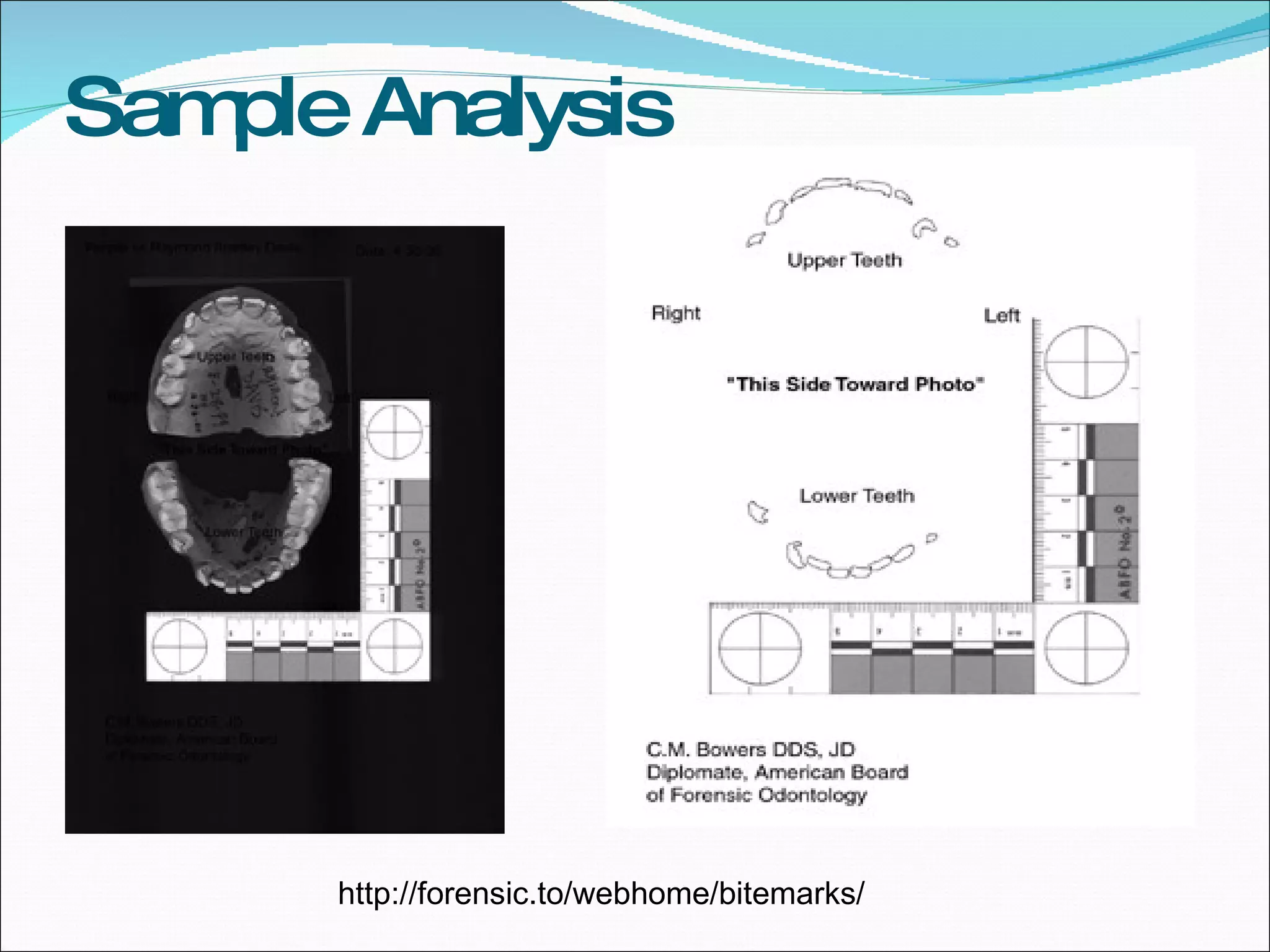 Sample Analysis http://forensic.to/webhome/bitemarks/ 