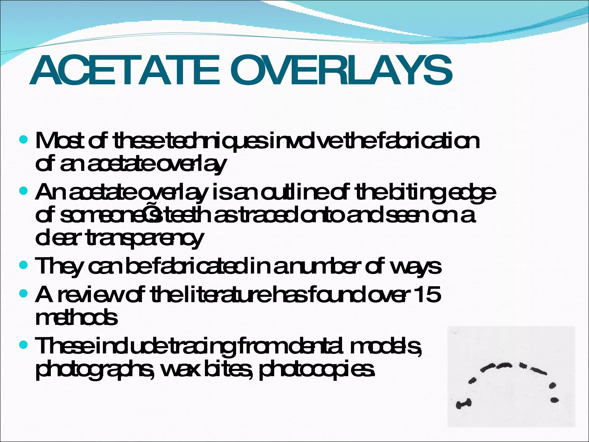 ACETATE OVERLAYS Most of these techniques involve the fabrication of an acetate overlay An acetate overlay is an outline of the biting edge of someone’s teeth as traced onto and seen on a clear transparency They can be fabricated in a number of ways A review of the literature has found over 15 methods These include tracing from dental models, photographs, wax bites, photocopies.  