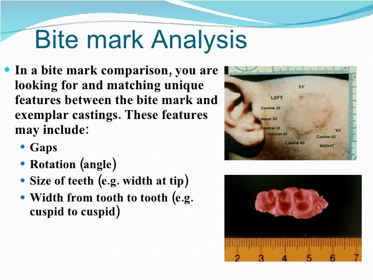 bite mark impression evidence bite mark impression evidence