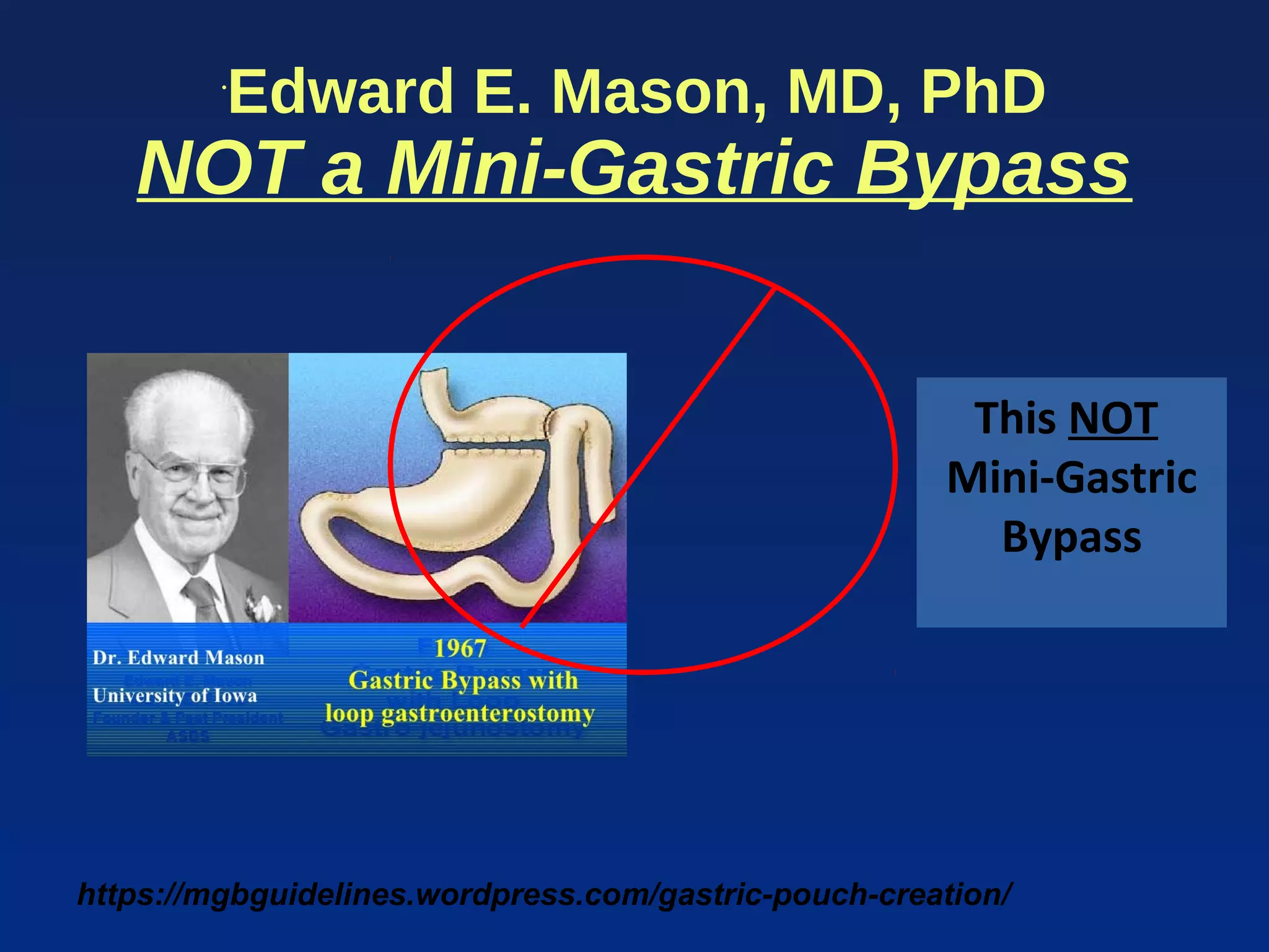 https://mgbguidelines.wordpress.com/gastric-pouch-creation/
•
Edward E. Mason, MD, PhD
NOT a Mini-Gastric Bypass
This NOT
Mini-Gastric
Bypass
 