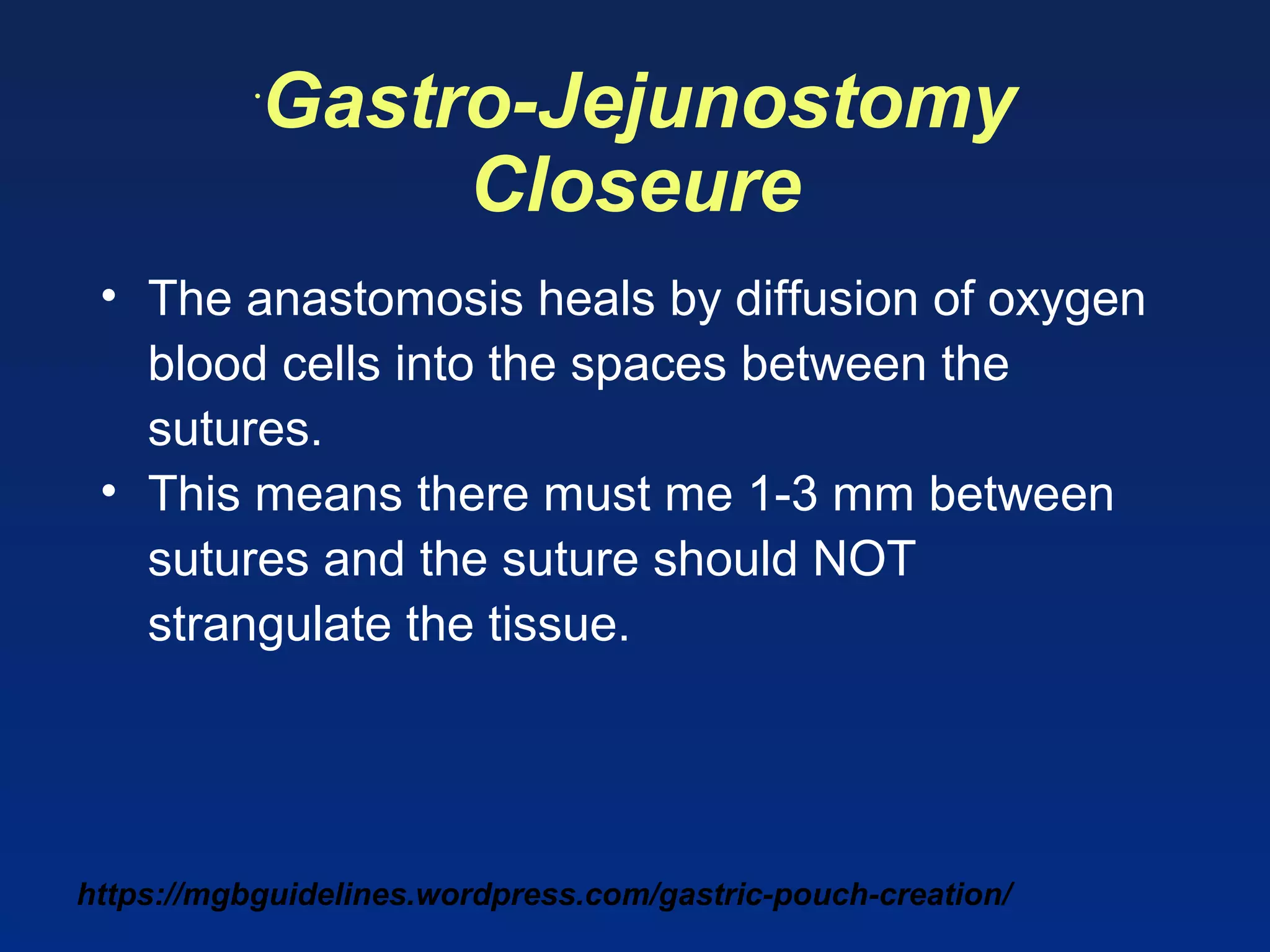 https://mgbguidelines.wordpress.com/gastric-pouch-creation/
•
Gastro-Jejunostomy
Closeure
• The anastomosis heals by diffusion of oxygen
blood cells into the spaces between the
sutures.
• This means there must me 1-3 mm between
sutures and the suture should NOT
strangulate the tissue.
 