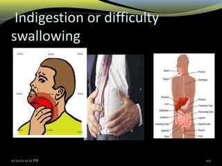 Indigestion or difficulty
swallowing
10/20/12 01:12 PM 102
 
