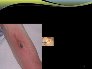 3/5/2021 12:13:36 AM 125
 