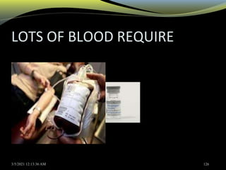 LOTS OF BLOOD REQUIRE
3/5/2021 12:13:36 AM 126
 