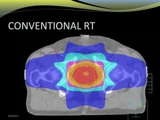 CONVENTIONAL RT
10/20/12 01:12 PM
 