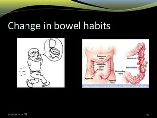 Change in bowel habits
10/20/12 01:12 PM 97
 