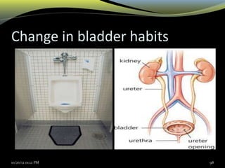 Change in bladder habits
10/20/12 01:12 PM 98
 