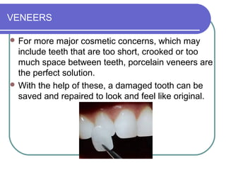 VENEERS
 For more major cosmetic concerns, which may
include teeth that are too short, crooked or too
much space between teeth, porcelain veneers are
the perfect solution.
 With the help of these, a damaged tooth can be
saved and repaired to look and feel like original.
 