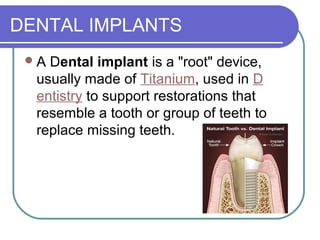 DENTAL IMPLANTS
A Dental implant is a "root" device,
usually made of Titanium, used in D
entistry to support restorations that
resemble a tooth or group of teeth to
replace missing teeth.
 
