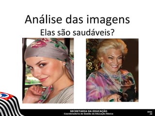 SECRETARIA DA EDUCAÇÃO
Coordenadoria de Gestão da Educação Básica
Slide
26
Análise das imagens
Elas são saudáveis?
 