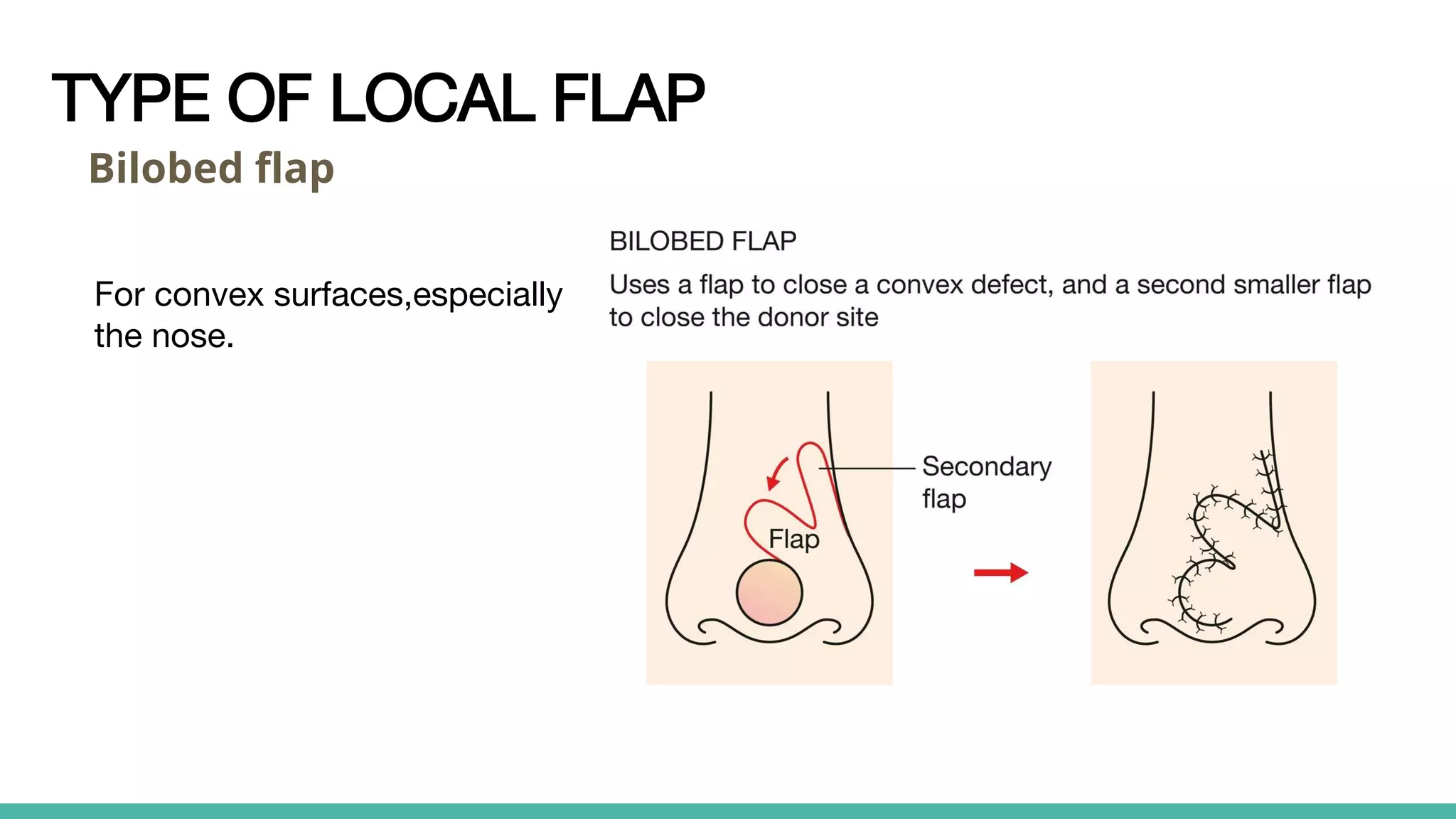 Different types of Skin graft & flap.pptx