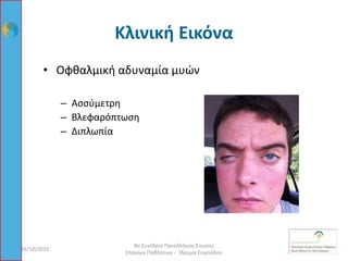Κλινική Εικόνα
16/10/2015
8ο Συνέδριο Πανελλήνιας Ένωσης
Σπανίων Παθήσεων - Ίδρυμα Ευγενίδου
30
• Οφθαλμική αδυναμία μυών
– Ασσύμετρη
– Βλεφαρόπτωση
– Διπλωπία
 